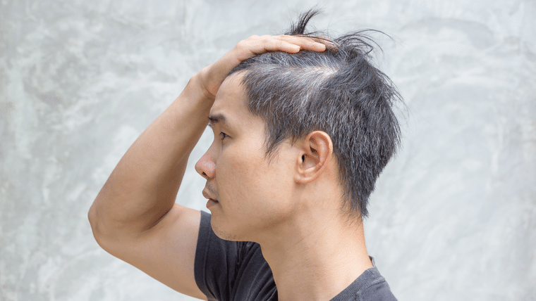 Top 24 Ways To Delay Graying Hair Selfhack